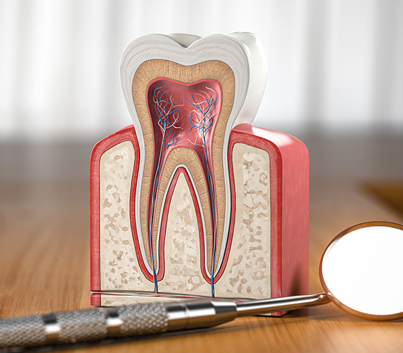 神経をできるだけ残すための治療（MTA）